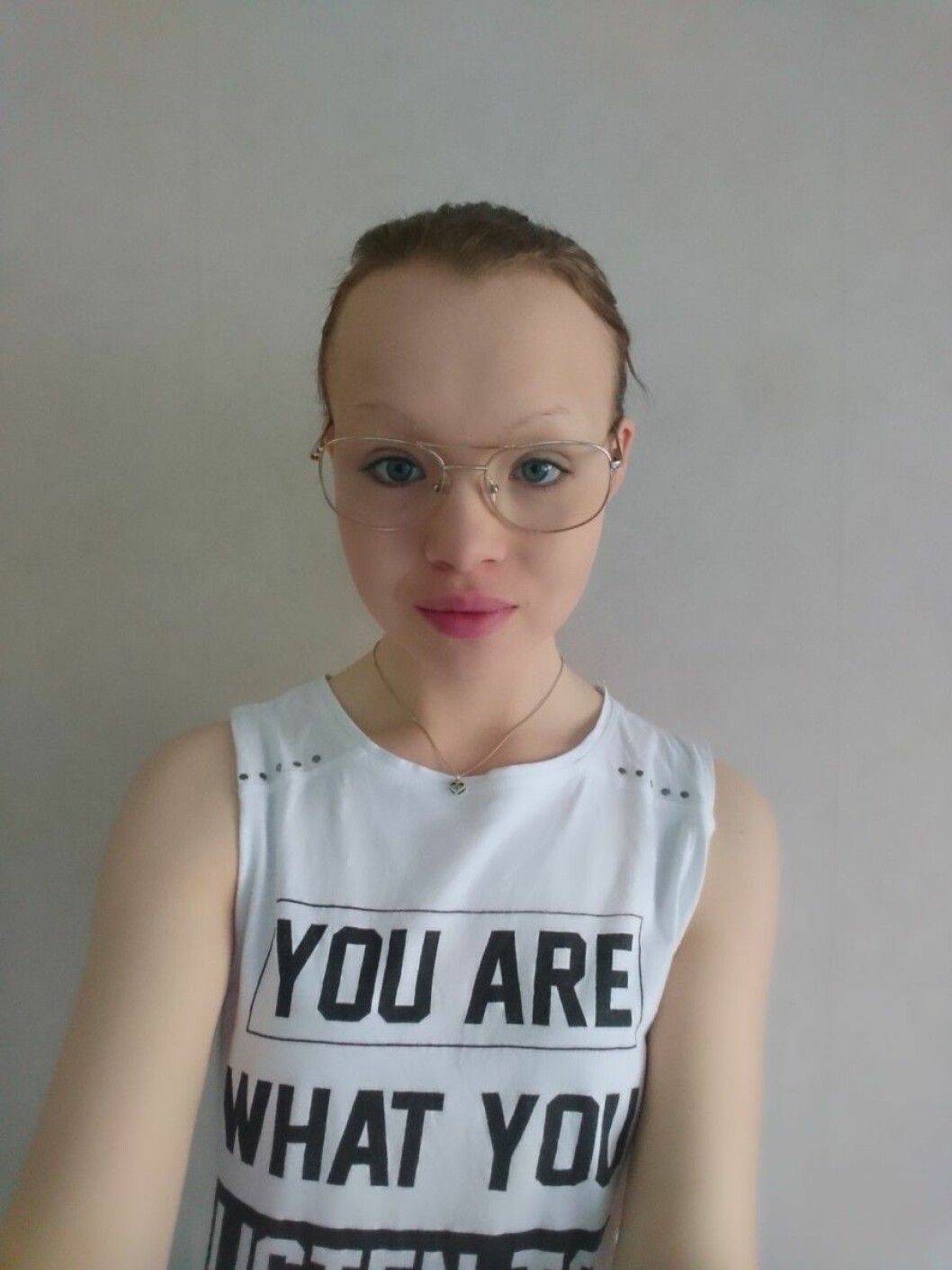 Felicia Fjällberg fick sin diagnos som 12-åring. Nu måste hon lära sig att leva med sjukdomen akalasi.
