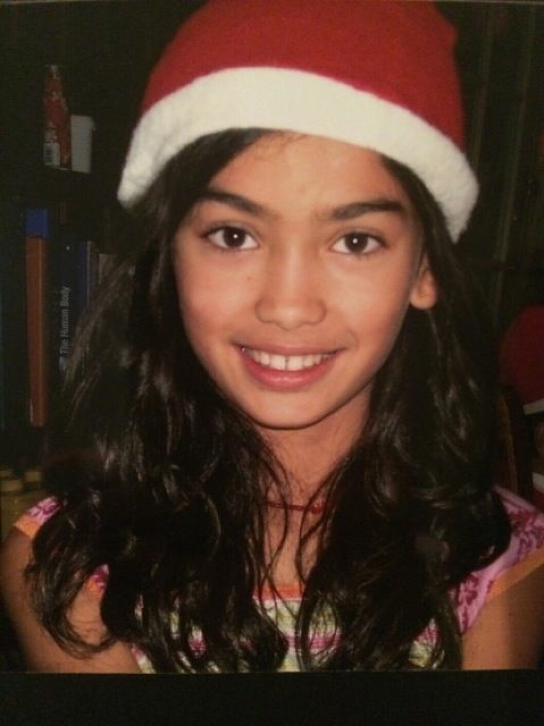 Kelly Gale mobbades i skolan. Idag är hon en världskänd modell. Kelly Gale mobbades i skolan. Idag är hon en världskänd modell.