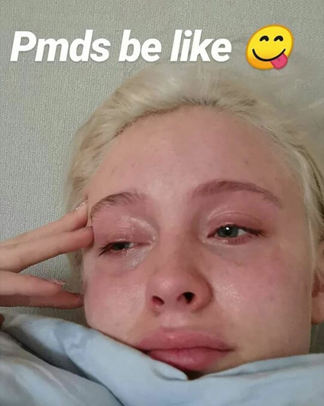 Zara Larsson PMDS